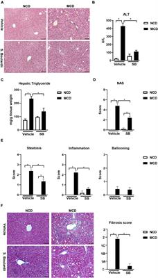 Saccharomyces Boulardii Ameliorates Non-alcoholic Steatohepatitis in Mice Induced by a Methionine-Choline-Deficient Diet Through Gut-Liver Axis